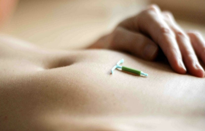 ¿Cómo funciona el dispositivo intrauterino?