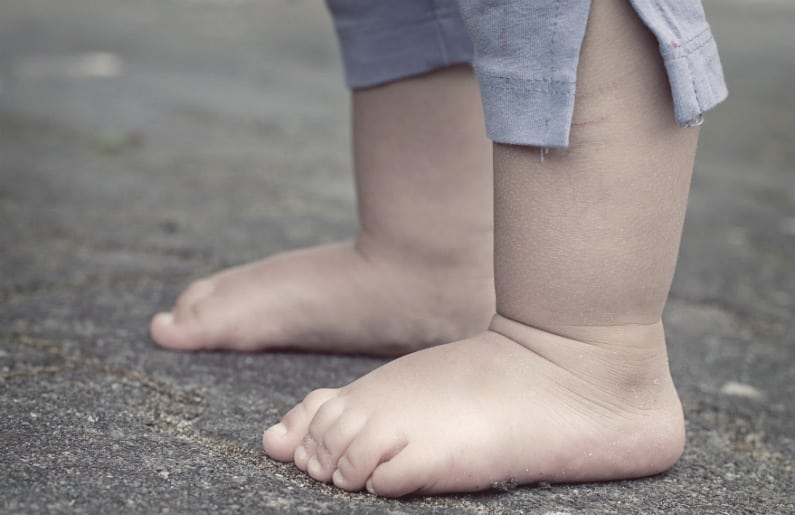 ¿Cómo saber si mi hijo tiene pie plano?