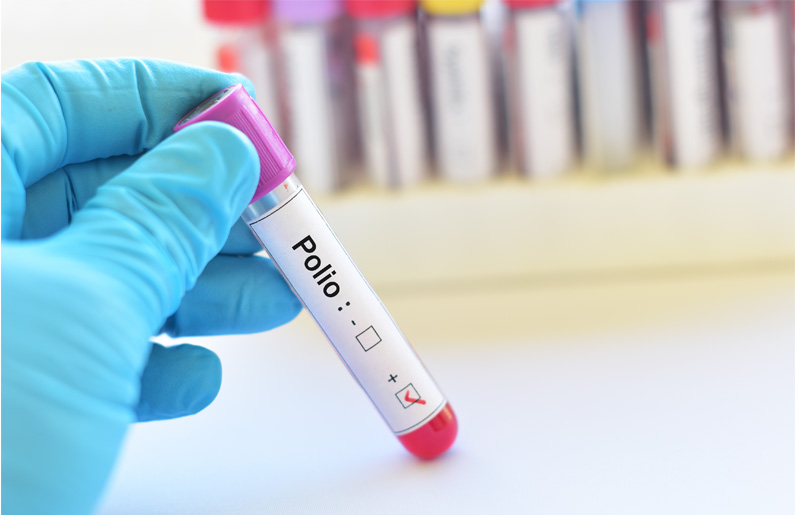 La polio, todo lo que necesitas saber