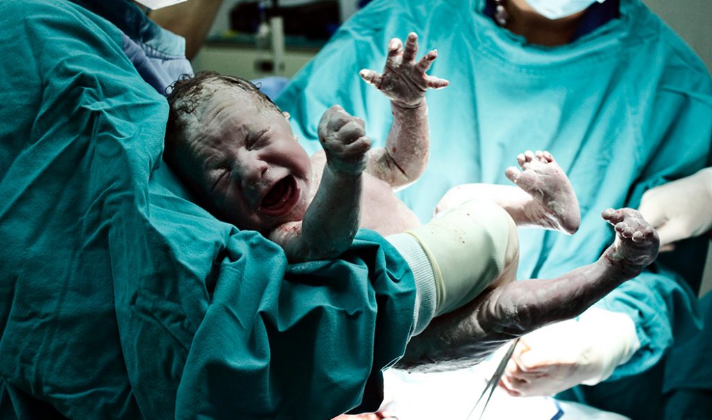 3 daños en el recién nacido cuando lo alejan de mamá