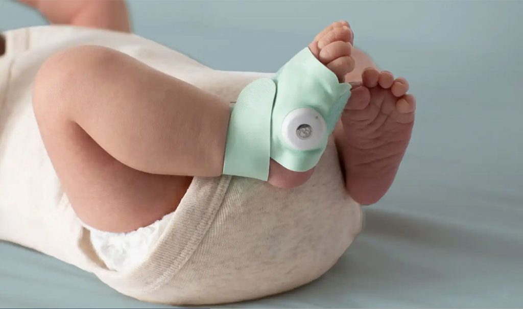 Calcetín inteligente que te dirá si tu hijo tiene anomalías